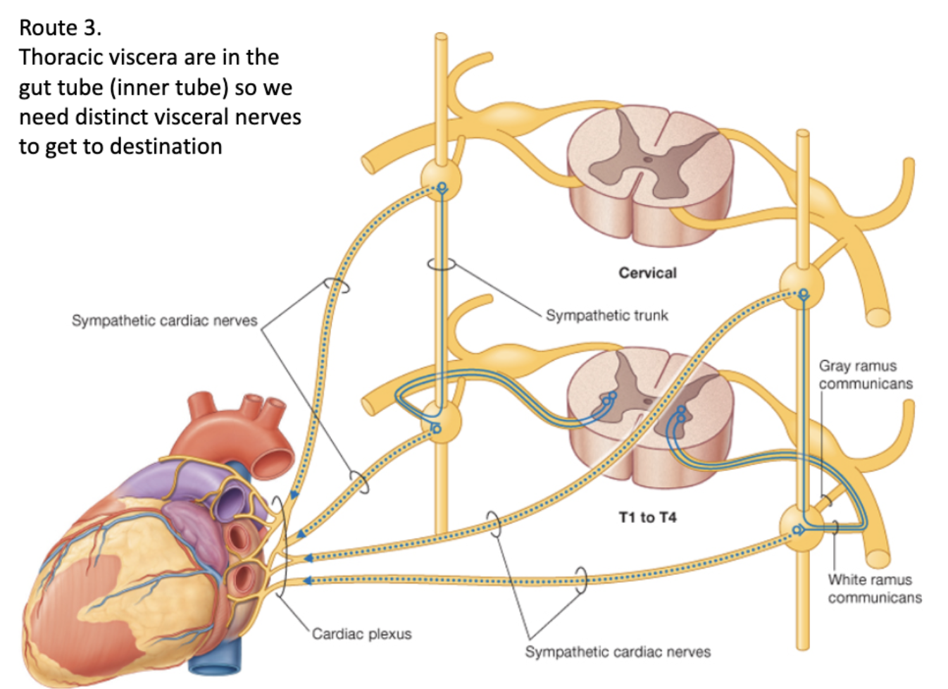 <p>Preganglionic cell body originates in the lateral horn </p><p>↓</p><p>Leaves via ventral root of spinal cord</p><p class="p2">↓</p><p class="p2">Goes through white ramus communicans</p><p class="p2">↓</p><p class="p1">Enters sympathetic chain ganglia</p><p class="p2">↓</p><p class="p1">Travels up/down/lateral chain ganglia</p><p class="p2">↓</p><p class="p1">Synapses at desired ganglia</p><p class="p2">↓</p><p class="p1">Leaves ganglia and enters specialized <strong>(does not leave by gray ramus)</strong></p><p class="p2">↓</p><p class="p1">Multiple cardiac plexi are created around the organ (<span>forms own </span>specialized <span>cardiac </span>nerves)</p>