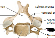 <p>superior view of cervical vertebrae</p>