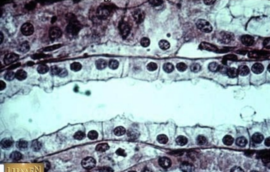 <p>simple cuboidal epithelium</p>
