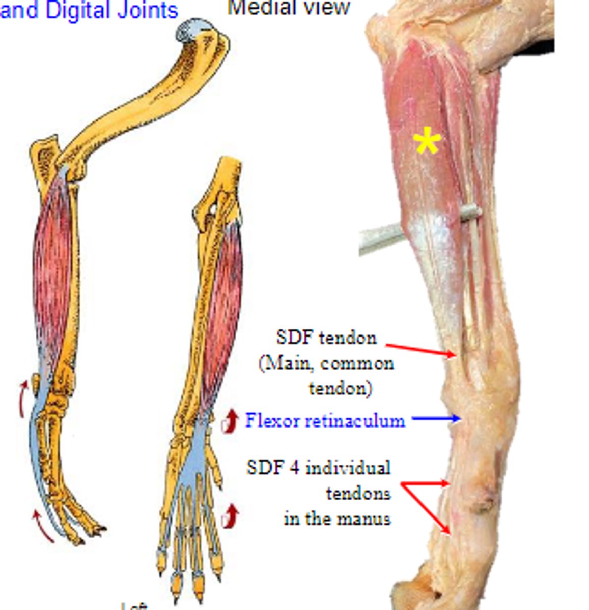 <p>Origin of superficial digital flexor:</p>