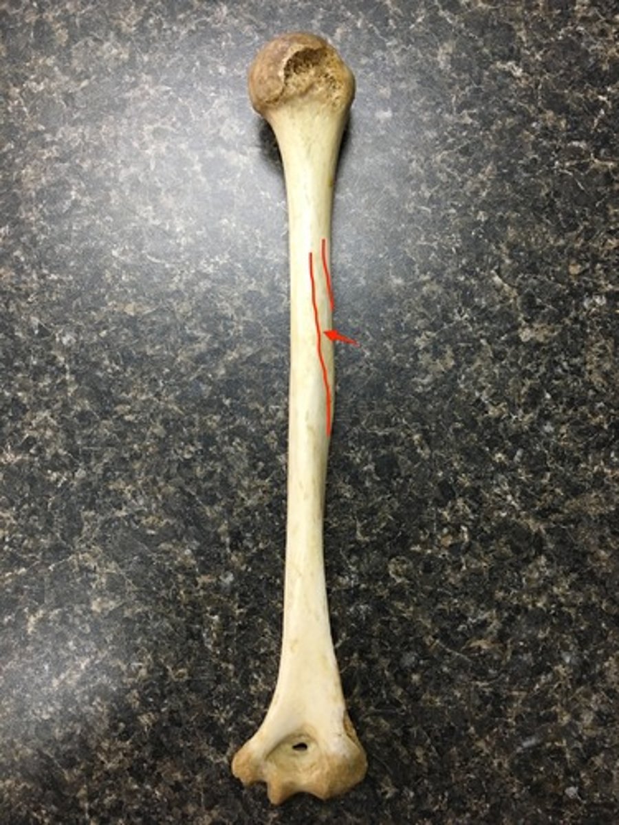 <p>ID the indentation</p>