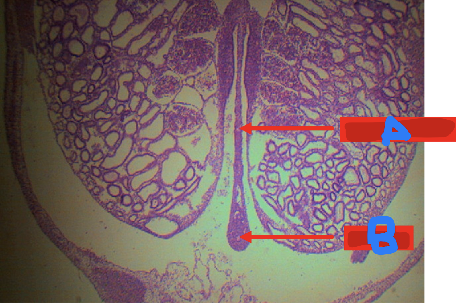 <p>Identify the structure</p>