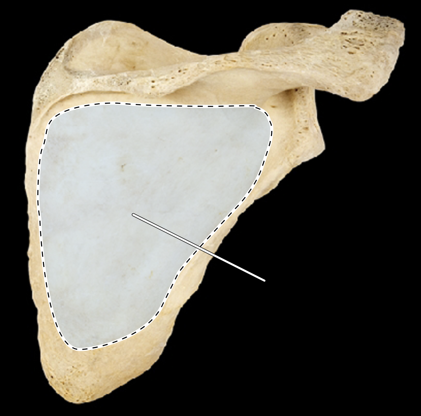 <p>Name the highlighted portion.</p><p>(Scapula, posterior view, right side).</p>