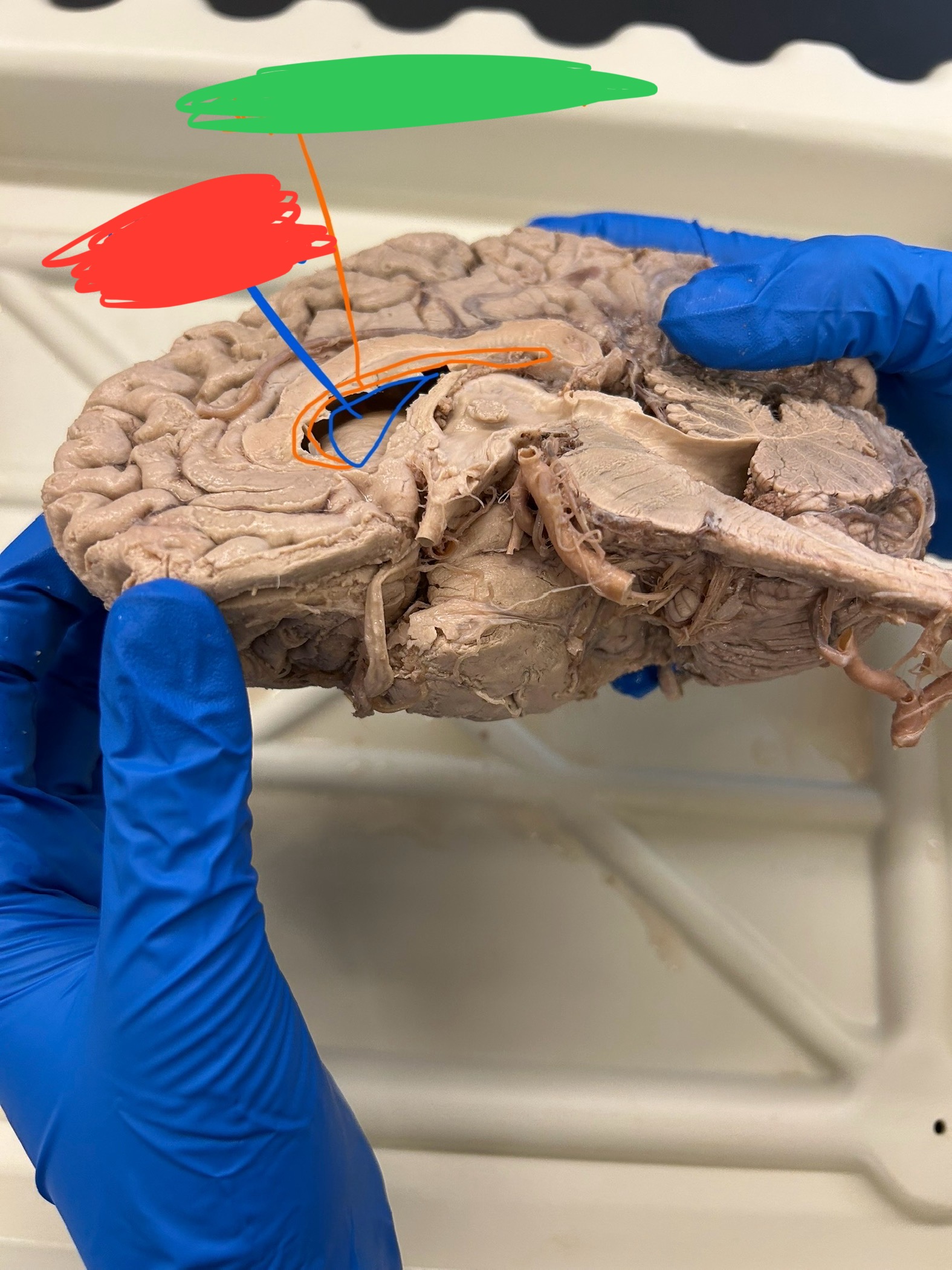 <p>What is the red?</p>