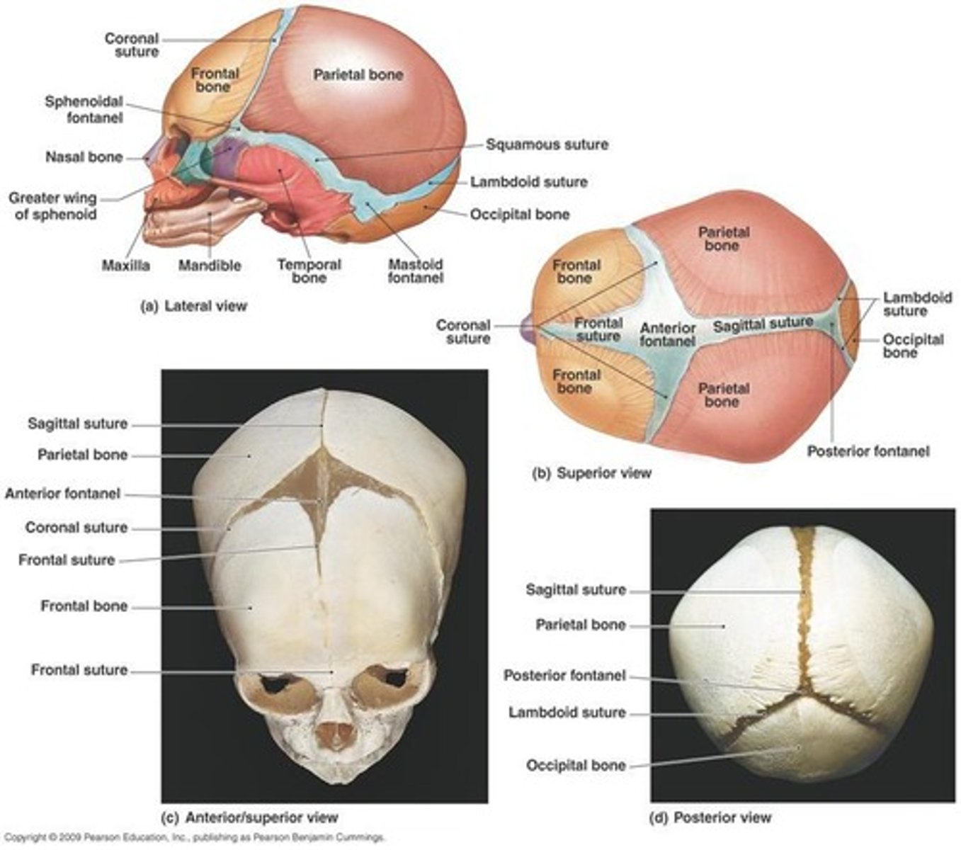 <p>A soft spot on an infant's skull that closes between 12-18 months.</p>