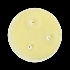 <p>En un medio de cultivo como el Mueller-Hinton, que es estandarizado para pruebas de susceptibilidad a antibióticos. Parecido al TSA.</p>