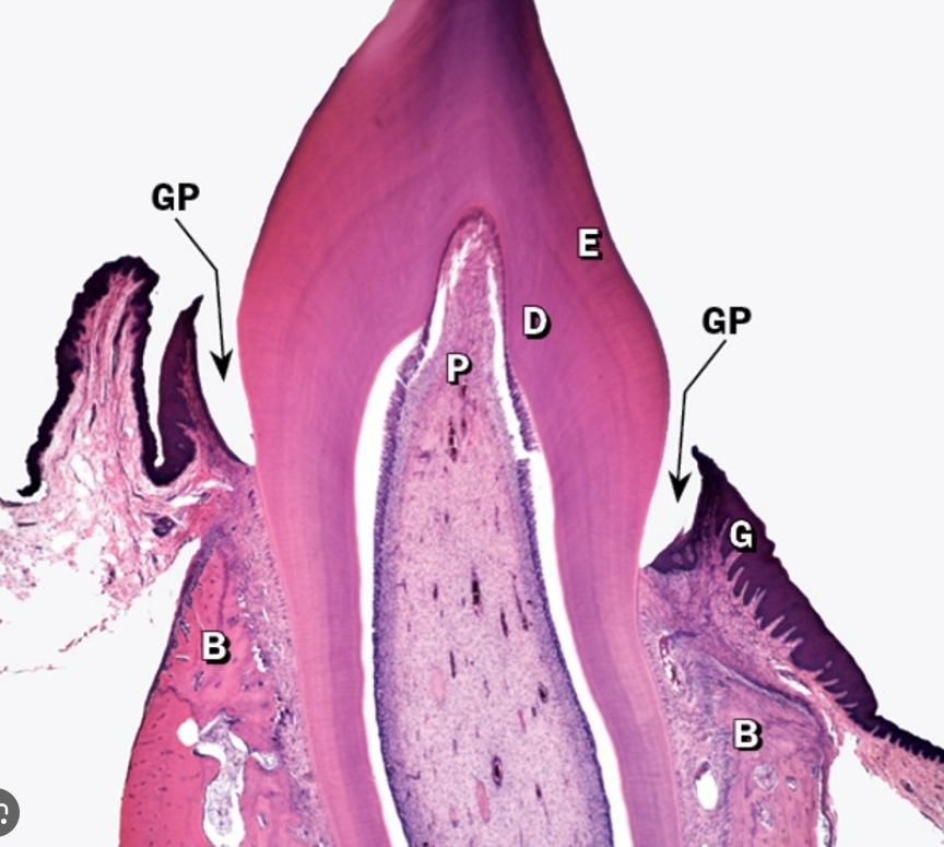 <p>Organ?</p>