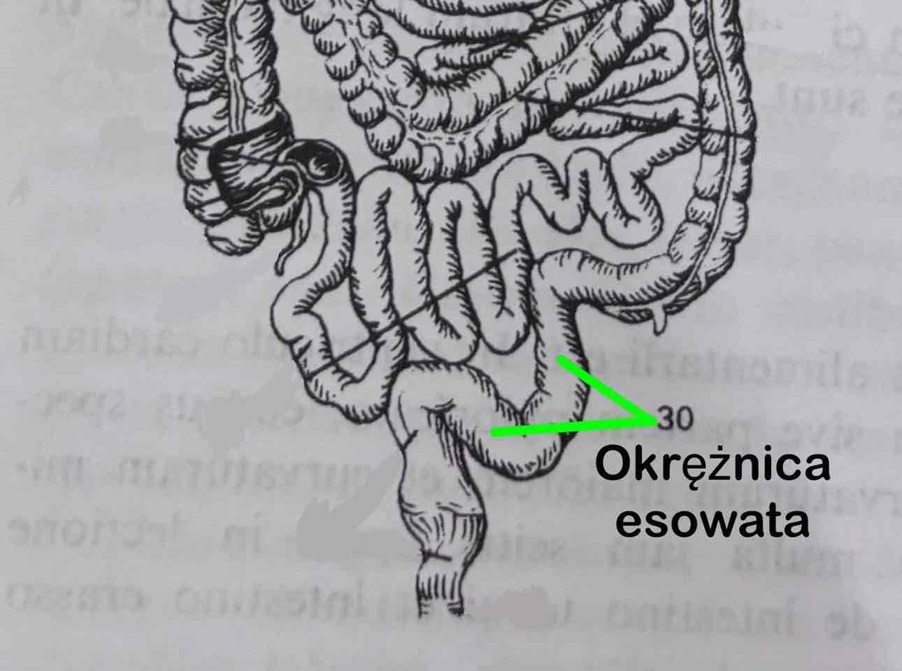 <p>Okrężnica esowata</p>