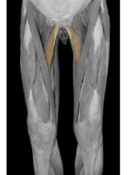 <p>Adductor Longus </p>