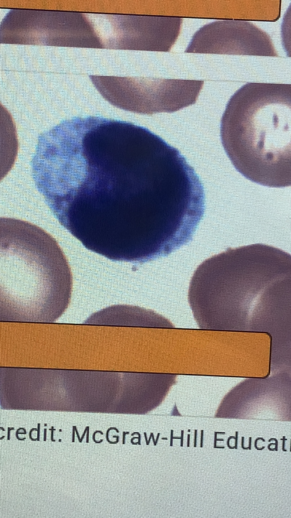<p>monocyte</p>