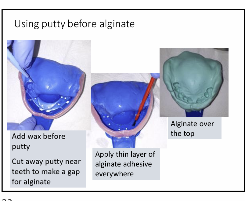 <p>What are the steps in using putty before alginate?</p>