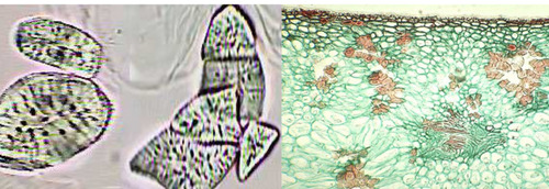 <p><span>• Usu. cubical or spherical<br>• More conspicuous pittings<br>• Sclerosis of parenchyma cells<br>• Isolated or scattered</span></p>