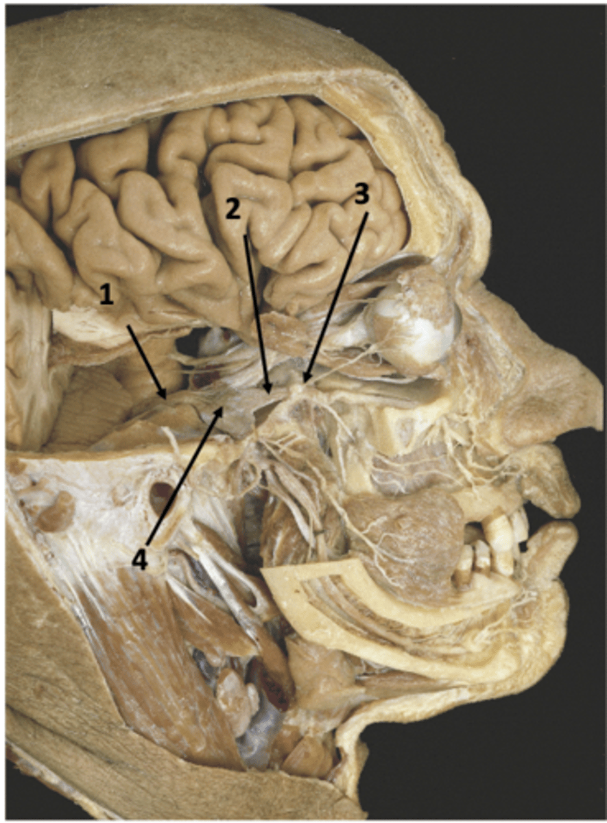 <p>Identify the structure at #3</p>