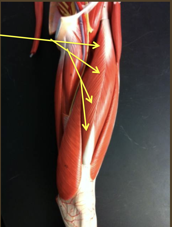 <p>The Rectus Femoris becomes are of the…</p>
