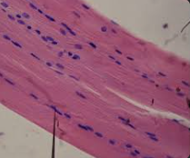 <p>What tissue type is this?</p>