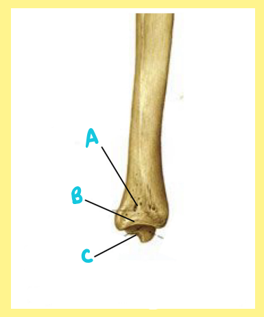 <p><u>Name the following</u>:</p><ul><li><p>Bone?</p></li><li><p>Side?</p></li><li><p>View?</p></li><li><p>B?</p></li></ul><p></p>