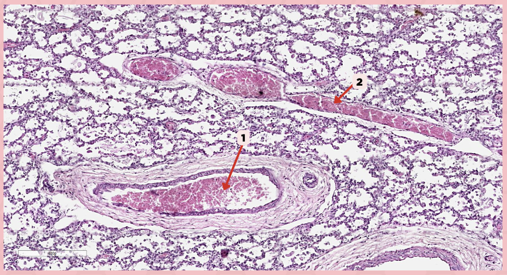 <p>Oxygenated blood is collected by structure #2 from what source/structure?</p>