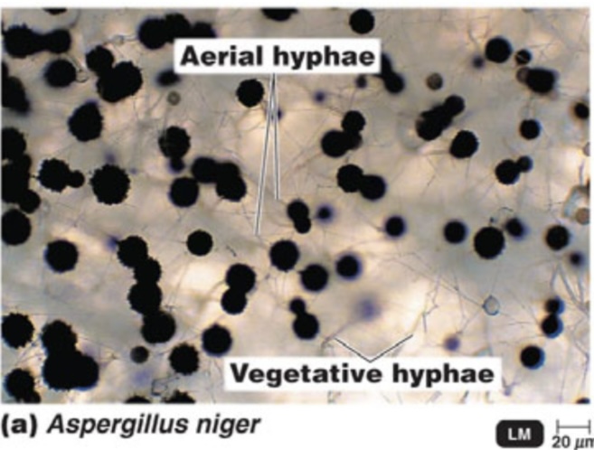 <p>Aspergillus niger</p>