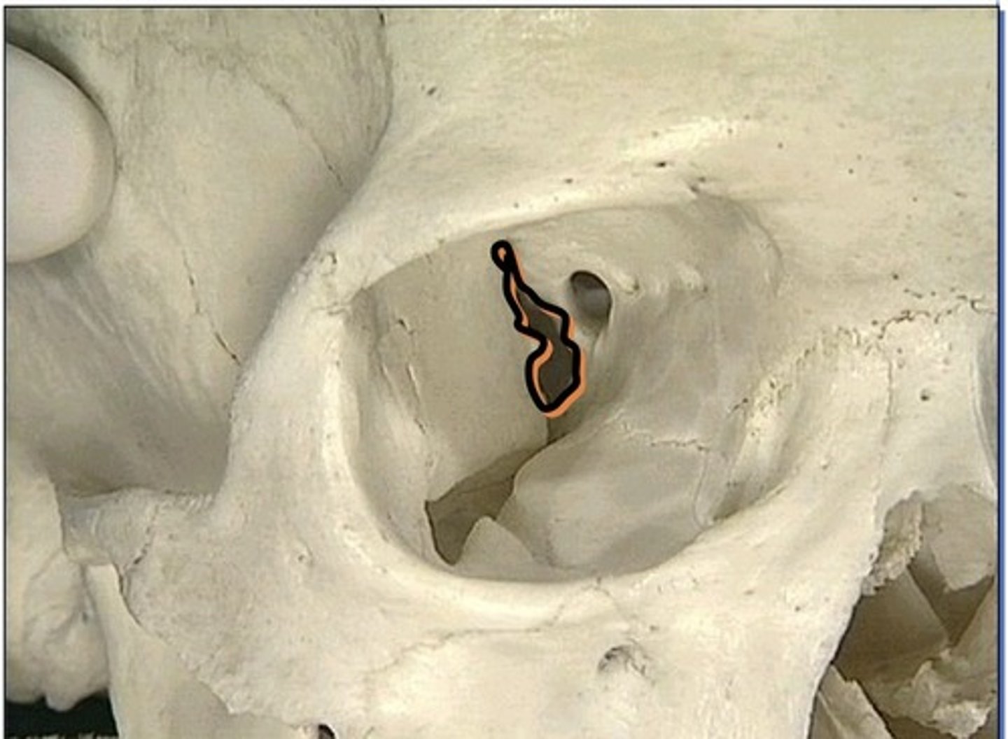 <p>1. Located superior in the orbit</p><p>2. Formed by the lesser and greater wing of sphenoid</p>