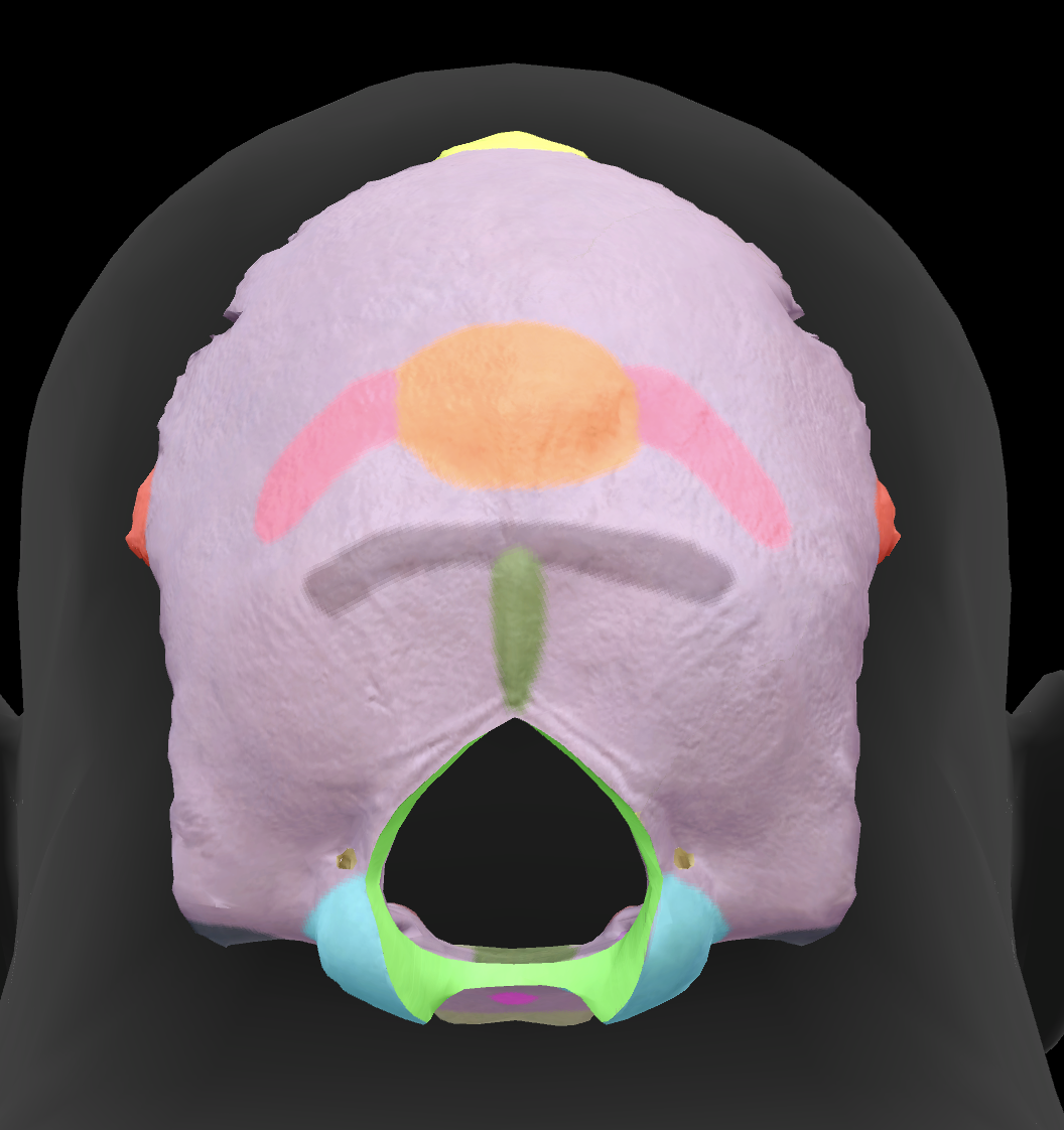 <p>What is the name of this feature?</p>