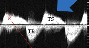 <p>TVA = ?</p>