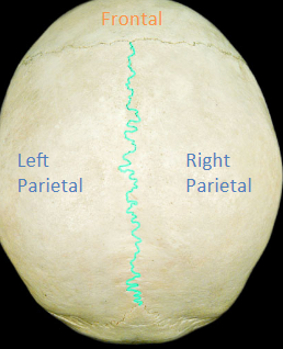 <p>the suture uniting the two parietal bones (running down the &quot;middle&quot;- &quot;midsagittal&quot;)</p>