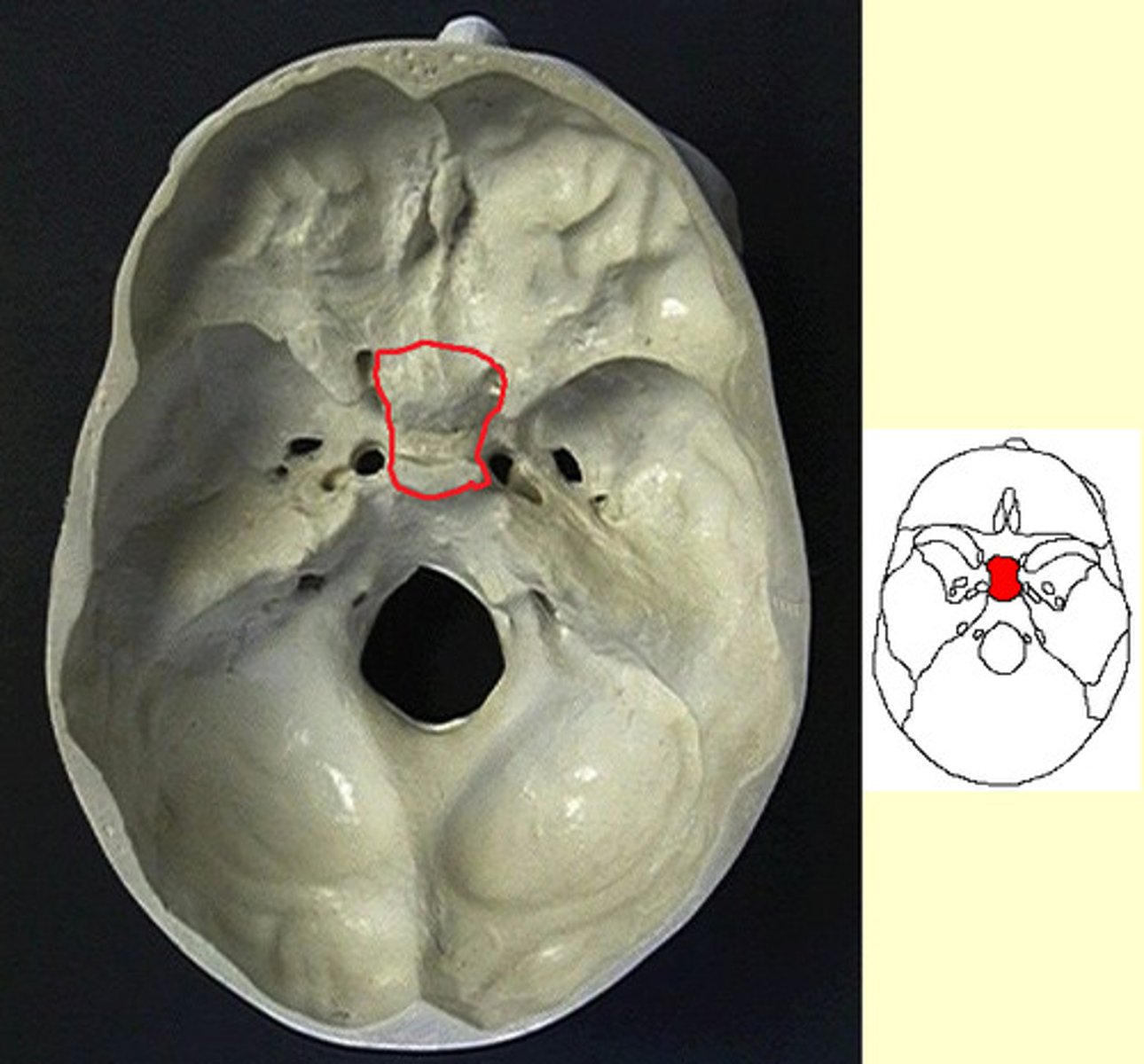 term image