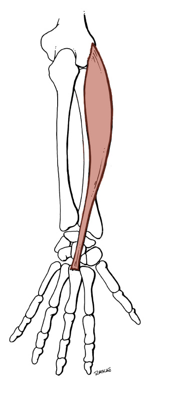 <p>Origin: <span>Common extensor tendon (lateral epicondyle of Humerus)</span></p><p>Insertion: <span>Dorsum of the third Metacarpal bone (base)</span></p><p>Action: <span>extends the wrist; abducts the hand</span></p>