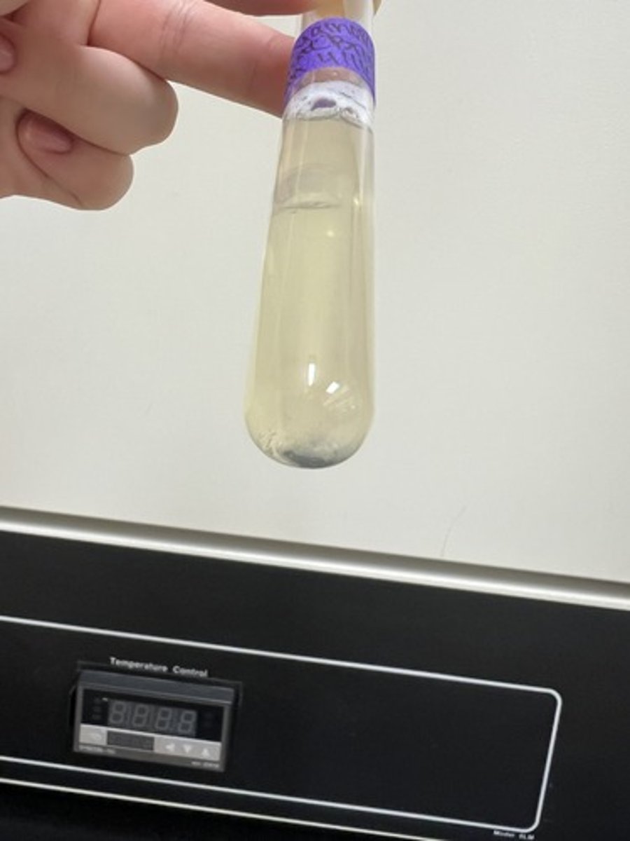 <p>Reduction of Nitrate to Nitrogen or Ammonia (N2 or NH3)</p>