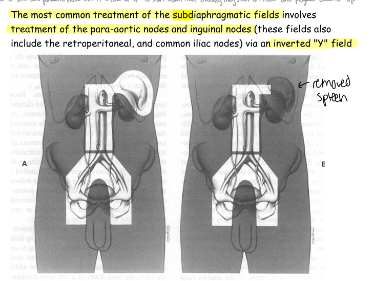 <p>3 &amp; 4</p><p><em>FYI: cuz after stage 3 and 4 there is positive lymph nodes in both sides of the diaphragm</em></p><p></p>