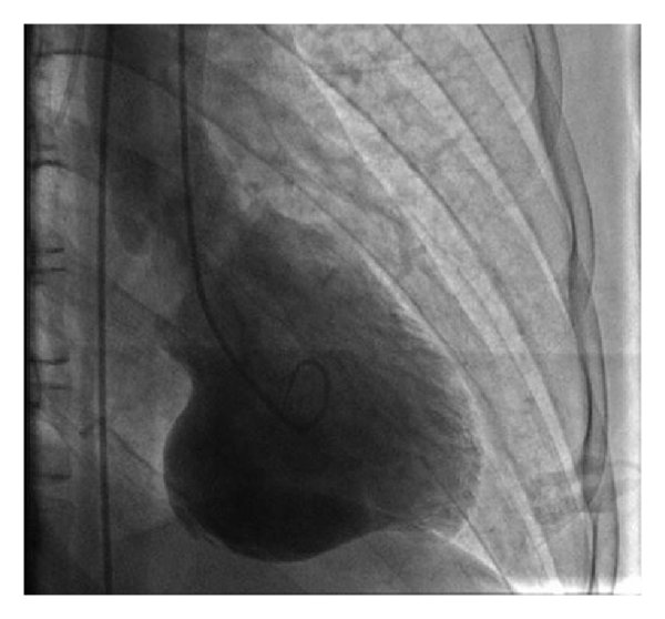 <p>Review the image carefully and give the abnormality seen in the image.&nbsp;</p><p><br></p>