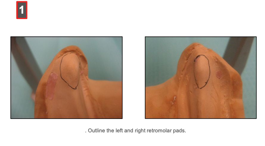 <p>to determine the height of the posterior occlusal plane in a complete denture set-up</p>