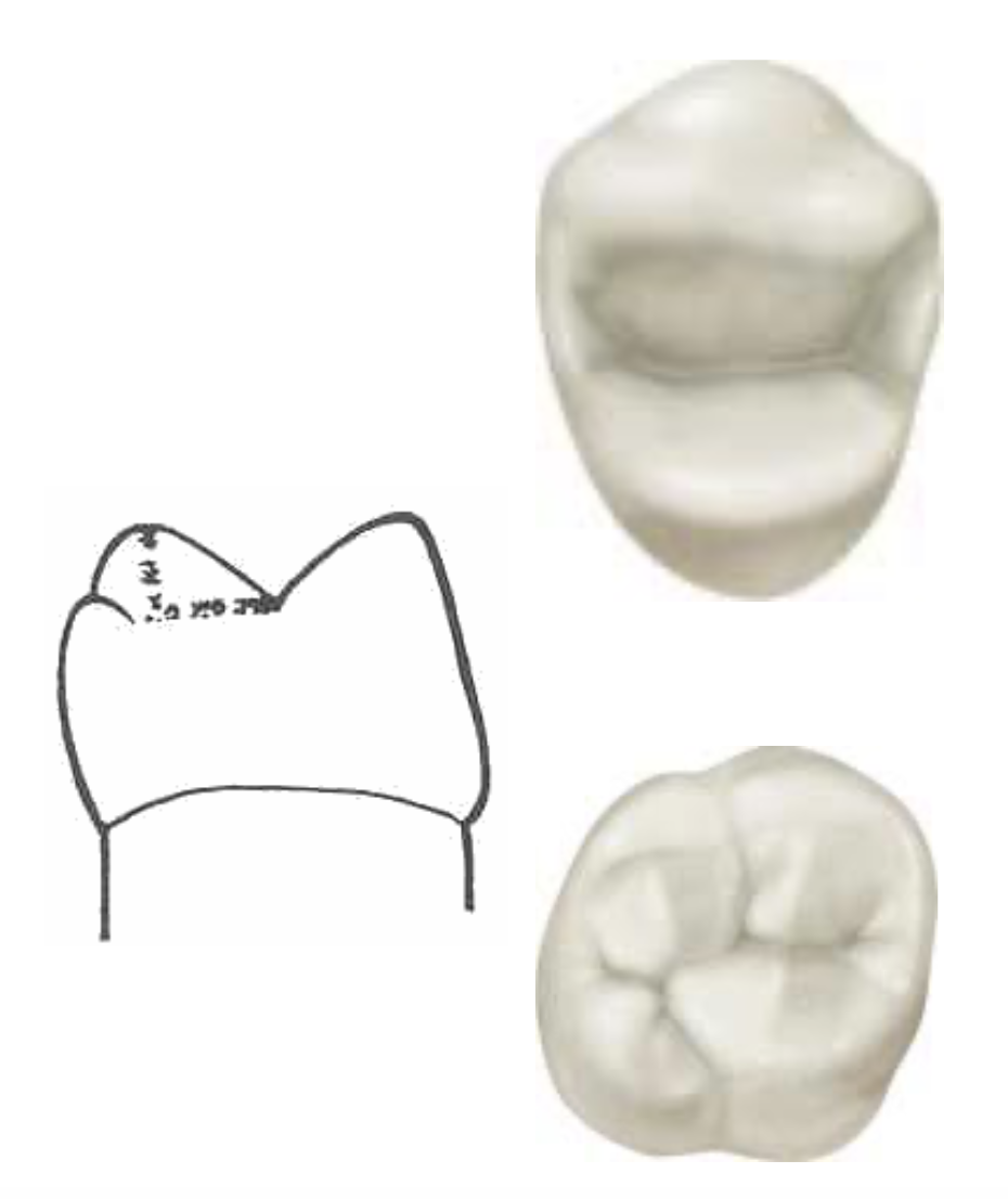 <p>Descend from the <strong>tips of the cusps</strong> of <strong><u>molars</u></strong> and <strong><u>premolars</u></strong> toward the central part of the occlusal surfaces</p>