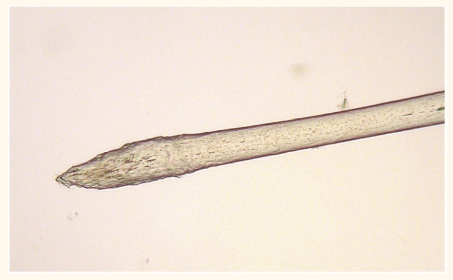 <p>Which growth stage is this hair in?</p>