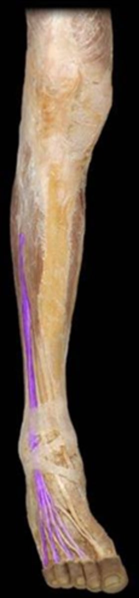 <p>Which of the following is the correct name for this muscle?</p><p>(answer only the letter that matches)</p><p>A) Flexor Digitorum Longus</p><p>B) Tibularis (Erroneus) Longus</p><p>C) Fibularis (Peroneus) Longus</p><p>D) Extensor Digitorum Longus</p>