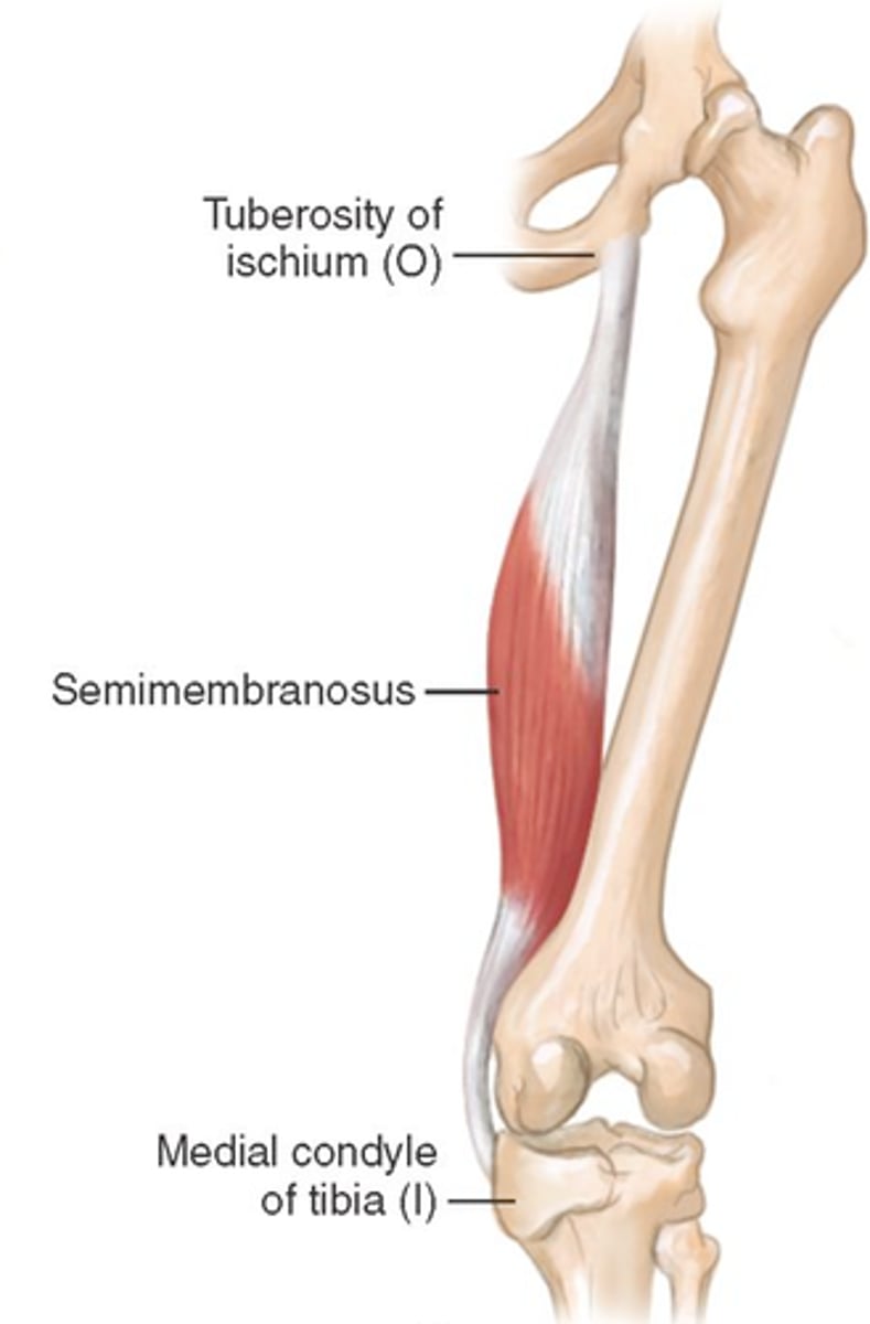 <p>ischial tuberosity</p>