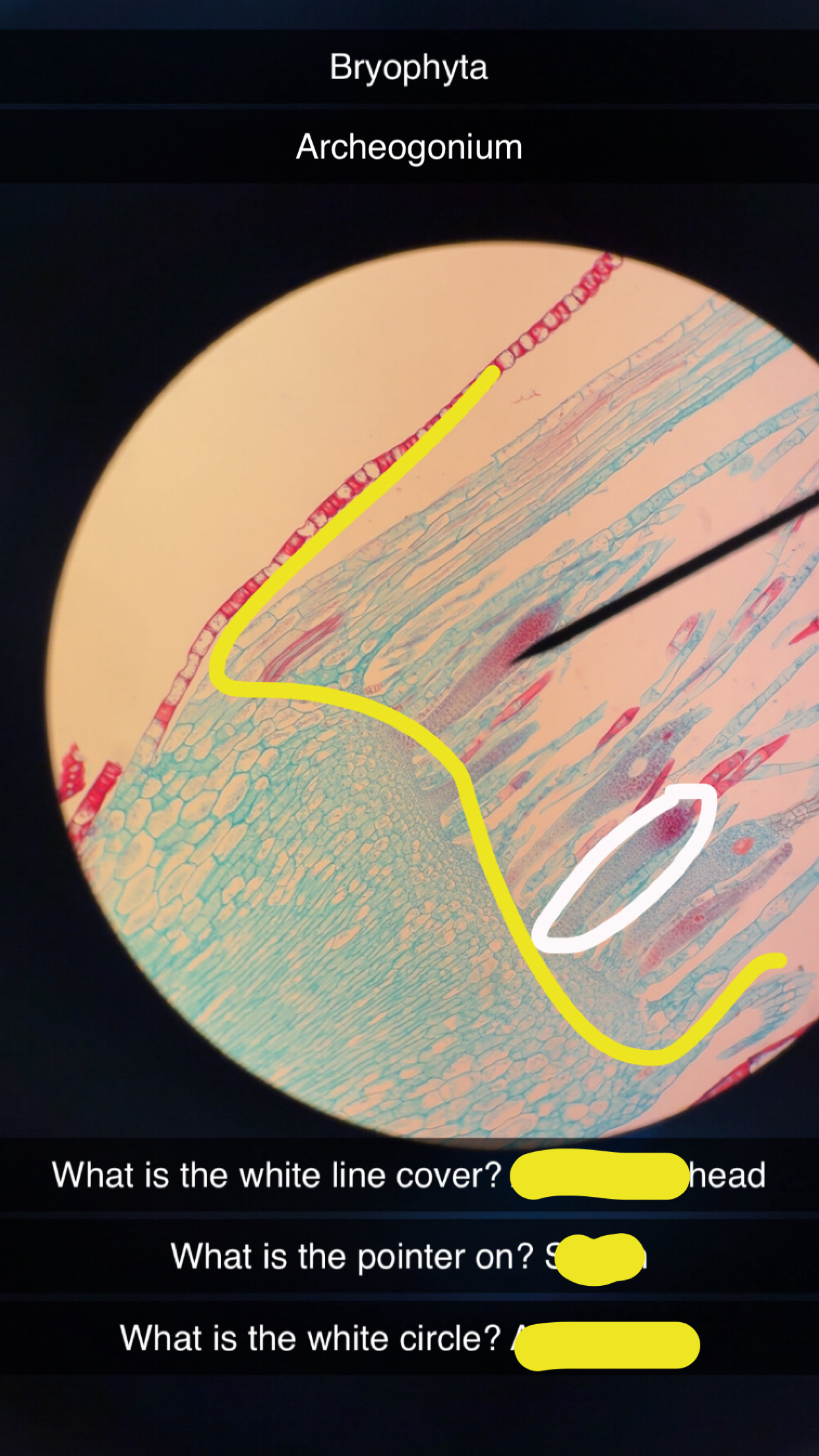 <p>What phylum </p>