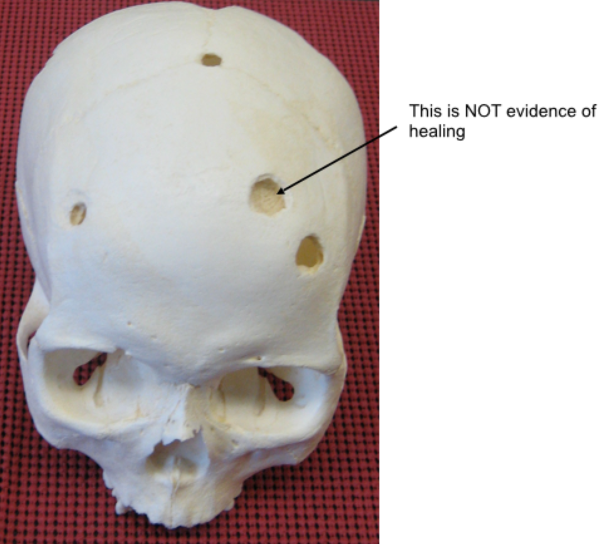 <p><span>Are these injuries antemortem, perimortem, or postmortem?</span></p>