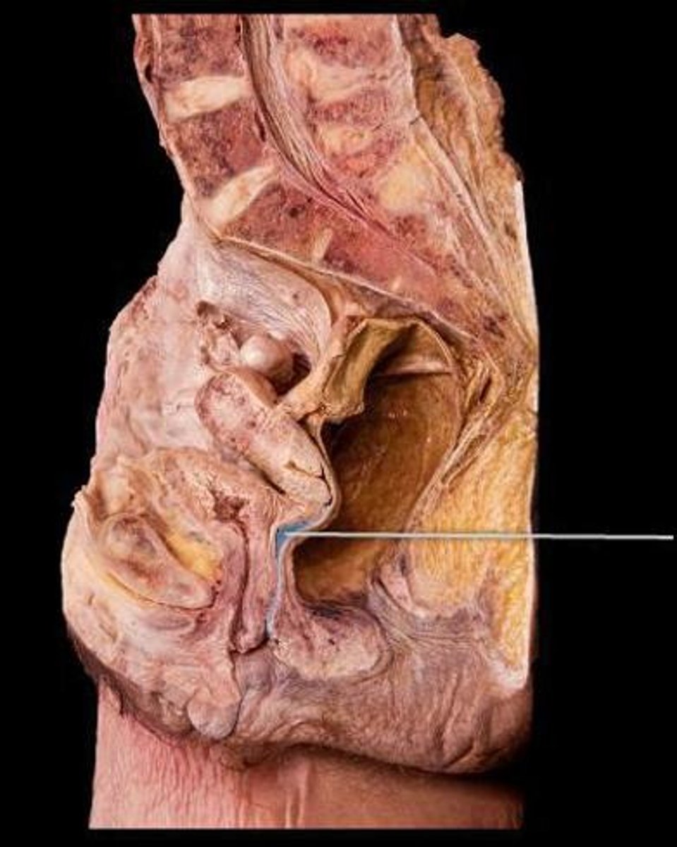 <p>stratified squamous</p>