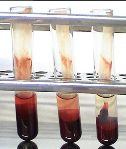 <p>Primary Haemostasis</p><p>PLT function test for Clot Retraction Time (CRT)</p><p>Which is which in each of these vials?</p>
