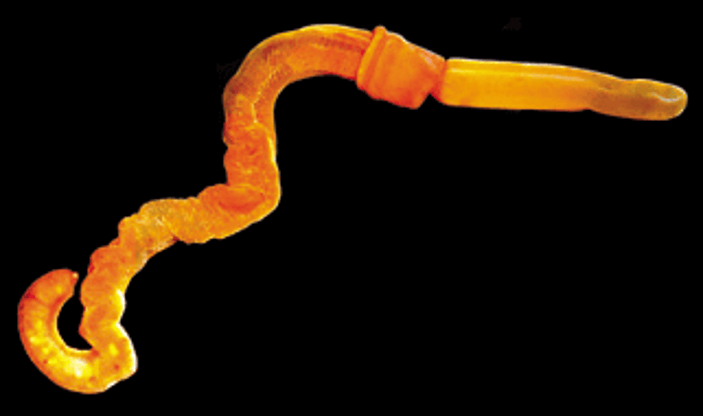 <p>acorn worms, under Phylum Hemichordata</p>