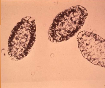 <p>where does <span><span>Dioctophyma renale live in the body of host </span></span></p>