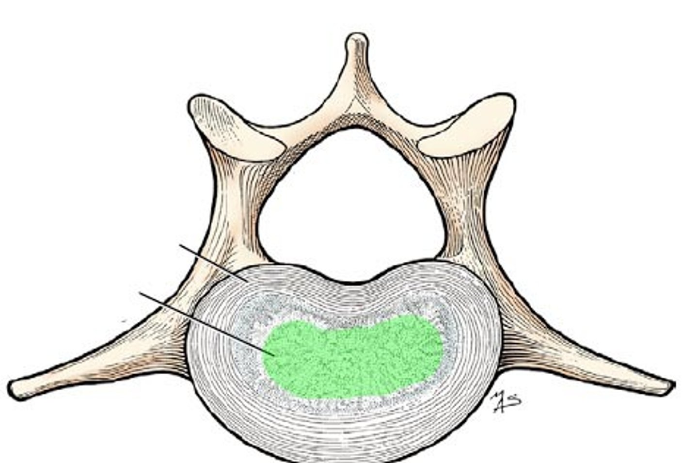 <p>Structure</p><p>- Remnant of the notochord</p><p>- Gelatinous</p><p>- High osmotic pressure</p><p>- Changes in size throughout day/with age</p><p>- Surrounded by annulus fibrosis </p>