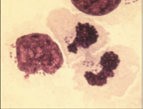 <p>What does this image show?</p>