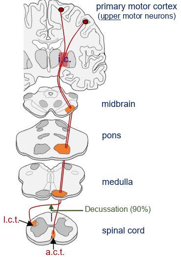 <p>in this picture, what does the i.c. and l.c.t. stand for?</p>
