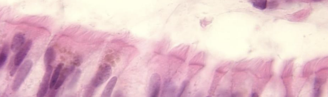 <p>What apical surface?</p>