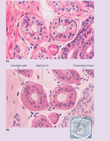 <p>Two or more layers of cells; surface cells squarish or rounded</p>