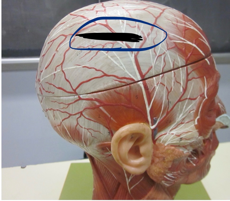 <p>Which muscle</p>