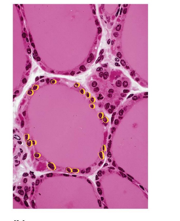 <p>Thyroid gland </p>