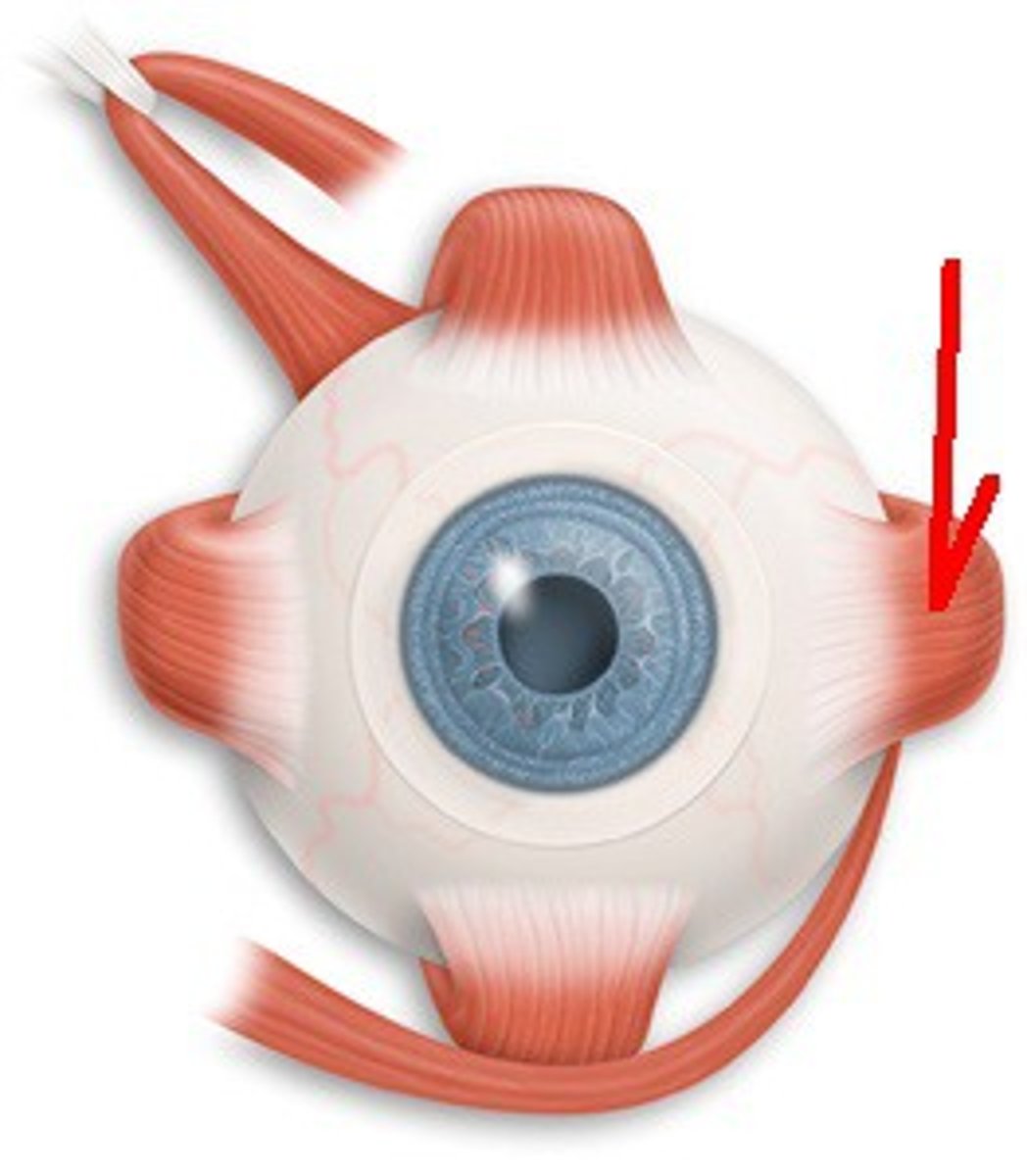 <p>What is this? (left eye)</p>